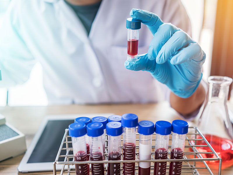 Final Settlement in Blood Reagents Antitrust Litigation Approved by Court